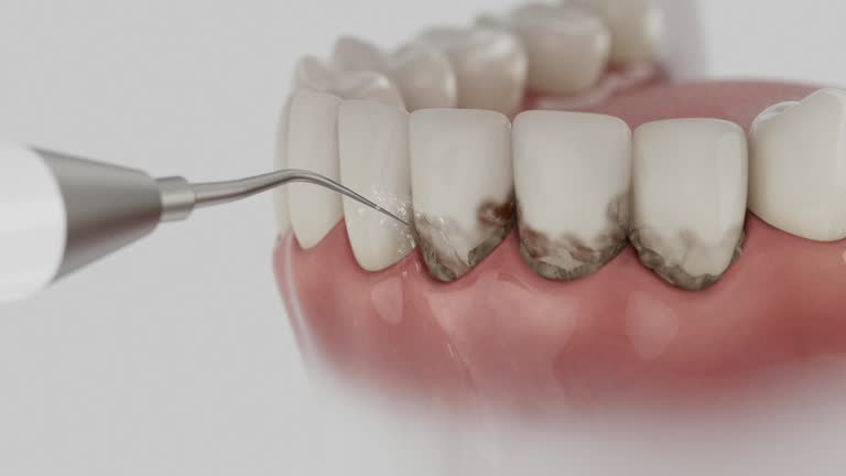 Reliable Dental Implants contractor in La Grulla, TX by Smile Center Dentistry